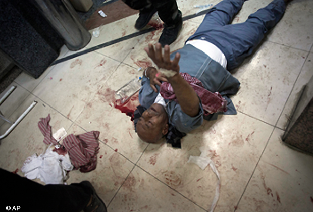 In this Wednesday, Oct. 10, 2012 photo, a wounded Syrian man begs for help while lying on the floor of Dar El Shifa hospital in Aleppo, Syria.(AP Photo/ Manu Brabo)